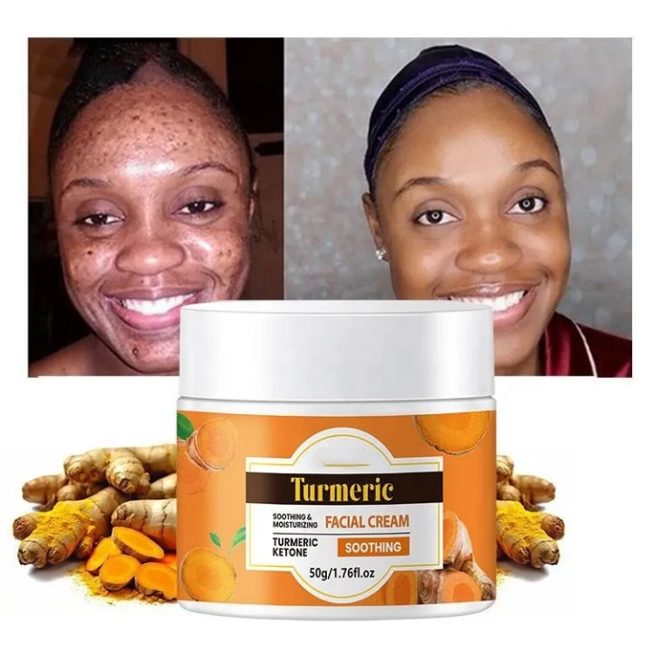 Crème de Visage Anti-Acné